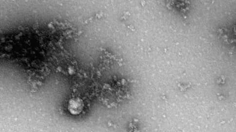 Новосибирские ученые сфотографировали «британский» штамм коронавируса