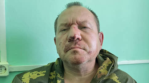 Член СПЧ Каляпин попал в больницу после нападения в Нижегородской области, подозреваемый задержан